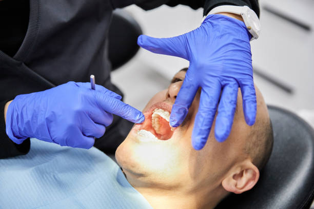 Best Emergency Dentist for Knocked-Out Tooth in Winsted, CT